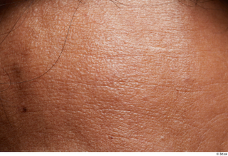 HD Face Skin Moises Molina forehead skin pores skin texture…